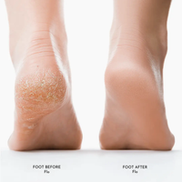 Flo-Foot Callus Remover