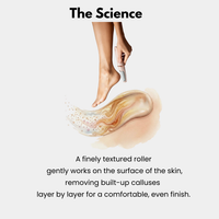 Flo-Foot Callus Remover